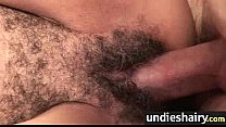 Hairy p...