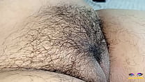 hairy a...