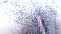 hairy m...