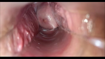 vaginal...