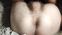 Hairy w...